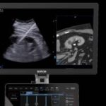 „Esaote“ parodoje ECR 2026 pristato naujus vaizdo gavimo sprendimus •